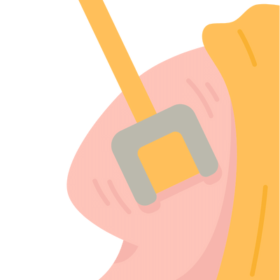 afbeelding van een dermaroller